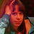 albina